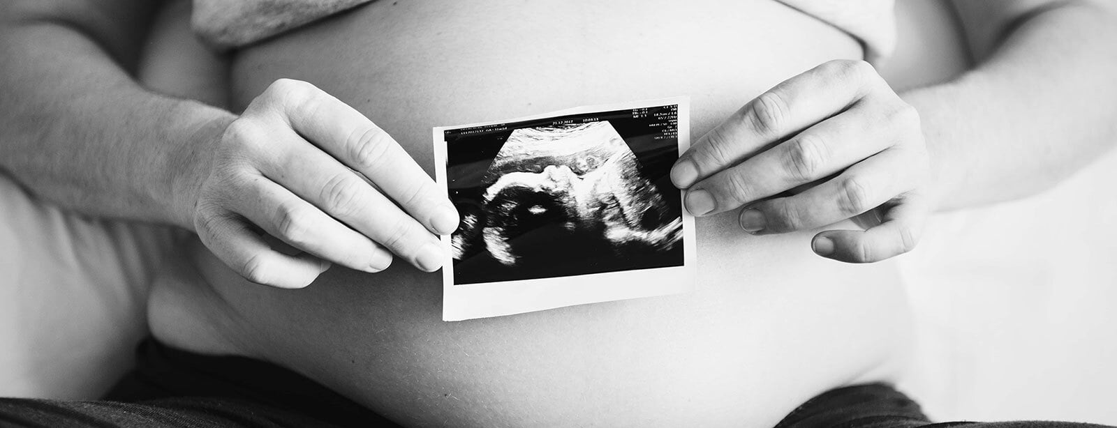 Prenatal Fetal Assessment
